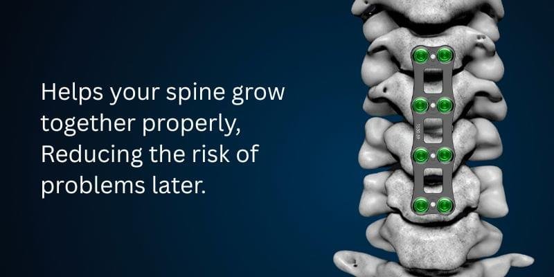 Anterior Cervical Plates