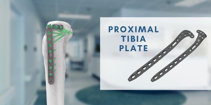 Proximal Tibia Plate
