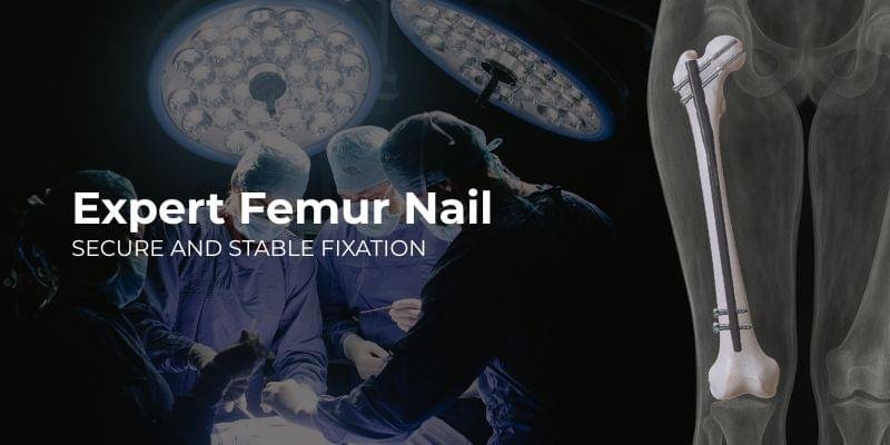 Expert Femur Nail